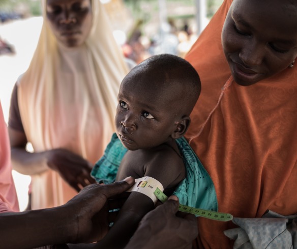 A child is measured for malnutrition at an Action Against Hunger nutrition screening in Mayahi, Niger.